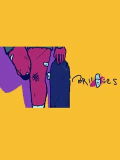 Bruises